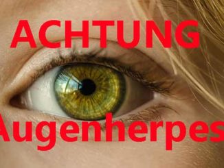 Augenherpes Verwechslung mit harmlosen Augenkrankheiten möglich Info von Dr. Nagy