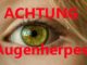 Augenherpes Verwechslung mit harmlosen Augenkrankheiten möglich Info von Dr. Nagy